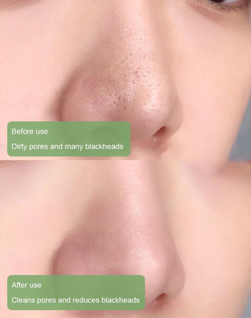 Melax™ Green Tea Deep Cleanse Mask Stick