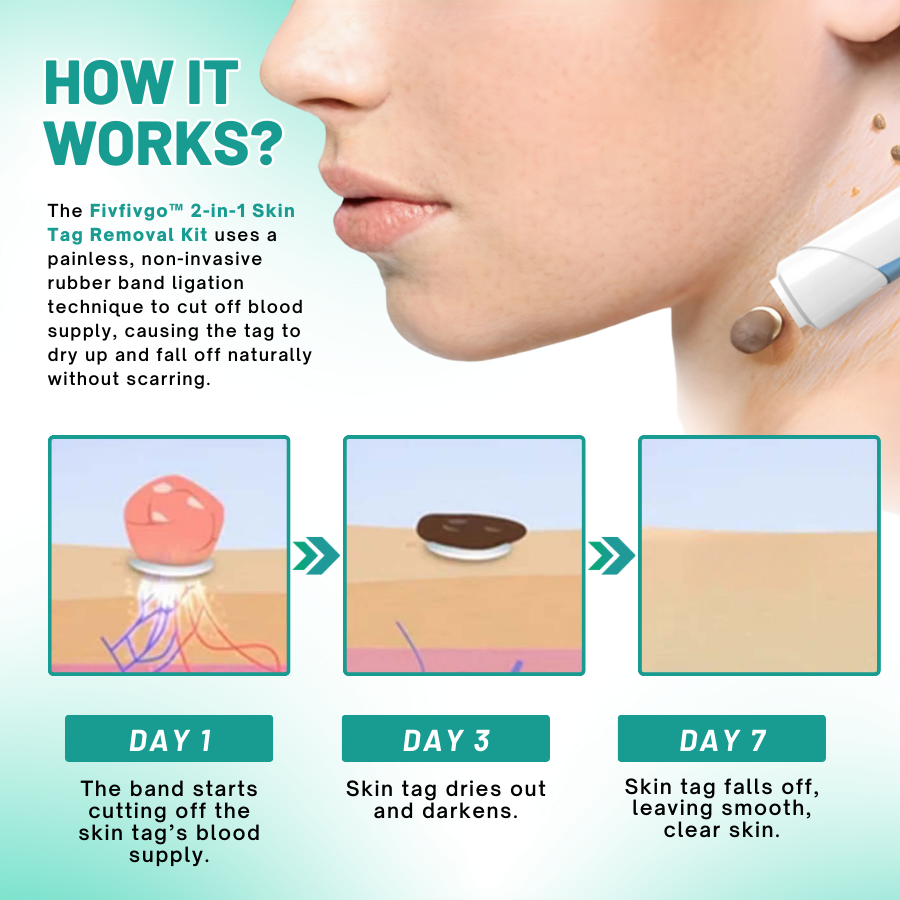 Melax™ 2-in1 Skin Tag Removal Kit