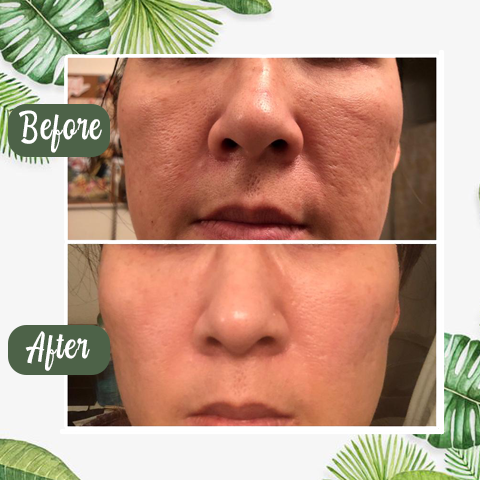 Melax™  Green Tea Deep Cleanse Mask Stick