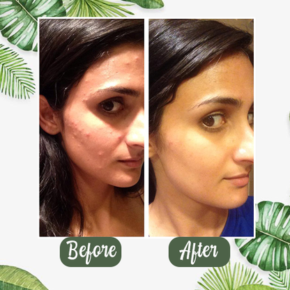 Melax™  Green Tea Deep Cleanse Mask Stick