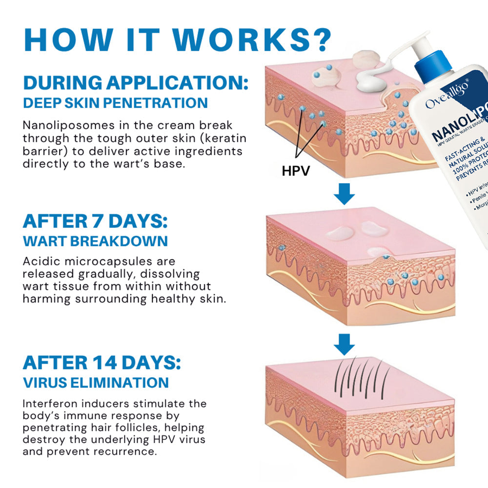 Melax® NanoLipo Therapy HPV Genital Warts Eraser Cream