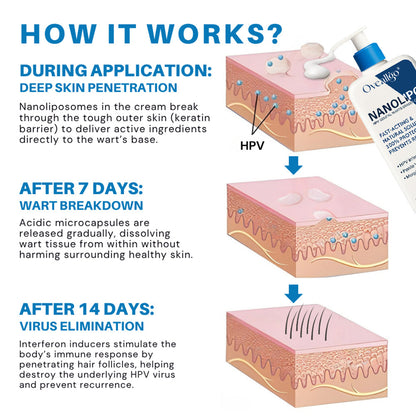 Melax® NanoLipo Therapy HPV Genital Warts Eraser Cream