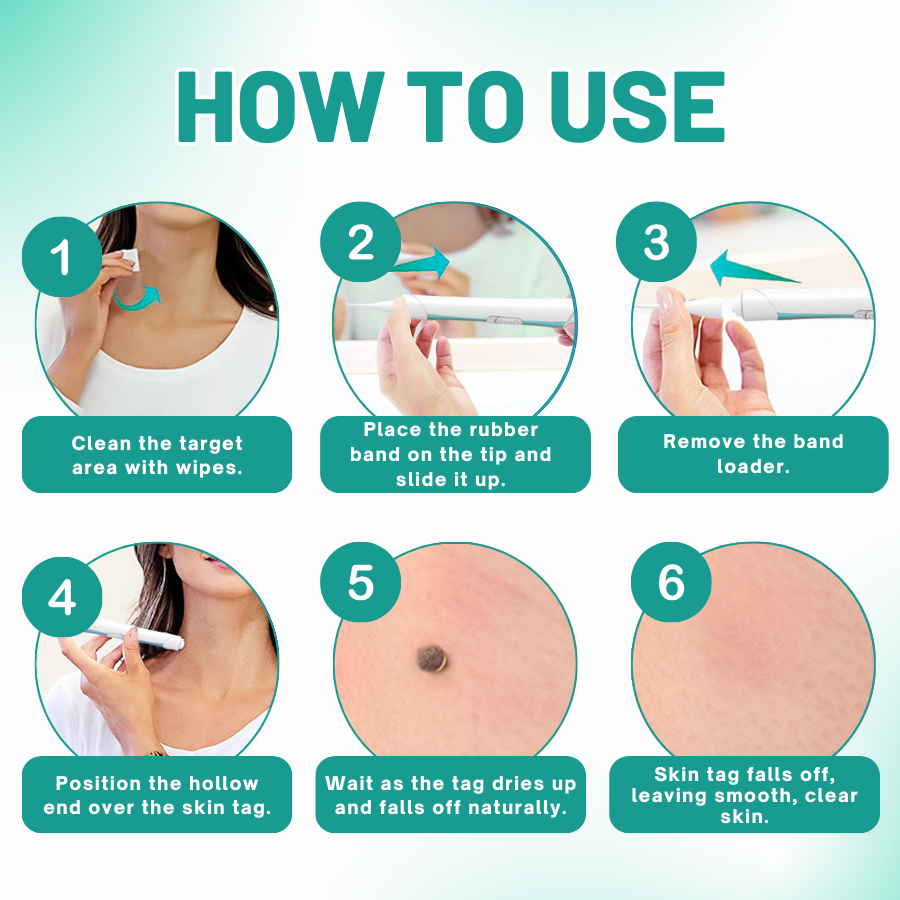 Melax™ 2-in1 Skin Tag Removal Kit