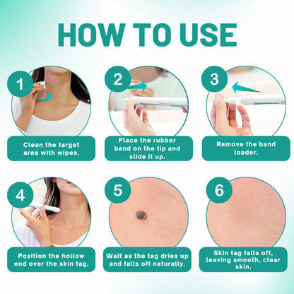 Melax™ 2-in1 Skin Tag Removal Kit