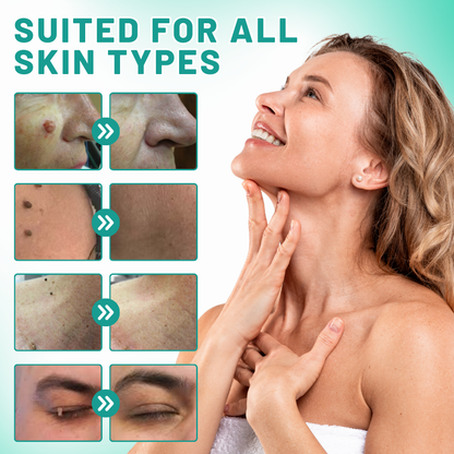 Melax™ 2-in1 Skin Tag Removal Kit